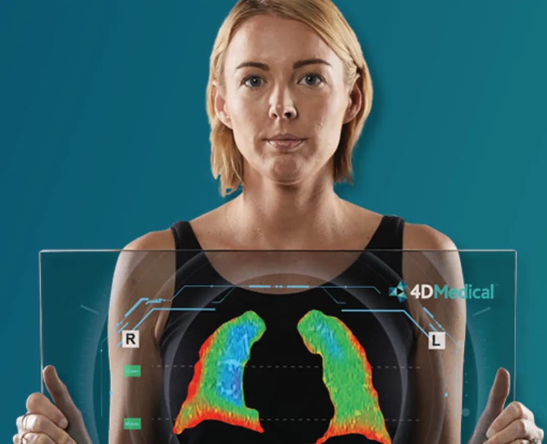 4DMedical (ASX: 4DX)